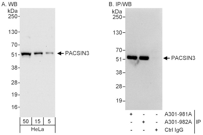 PACSIN3 Antibody in Western Blot (WB)