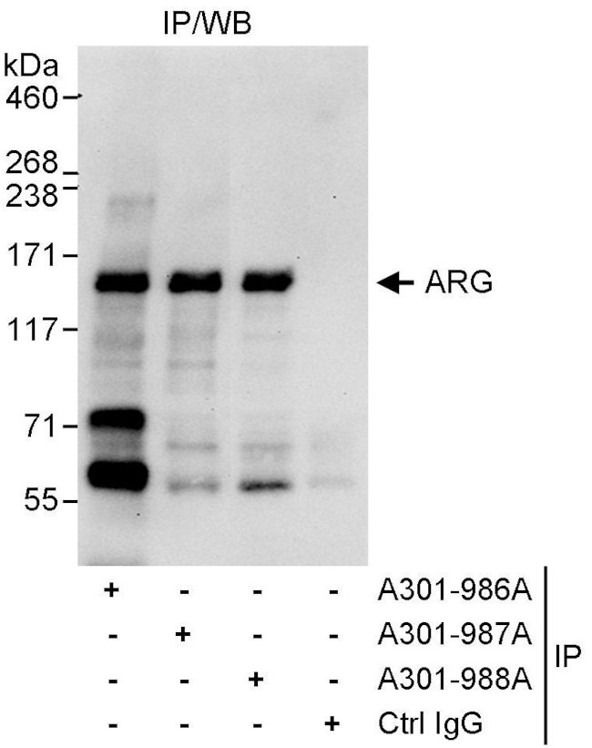 ARG Antibody in Immunoprecipitation (IP)