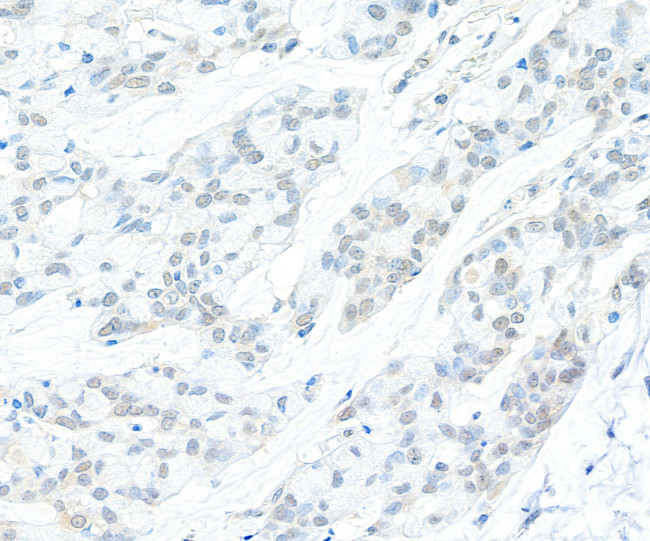 Cyclin C Antibody in Immunohistochemistry (Paraffin) (IHC (P))