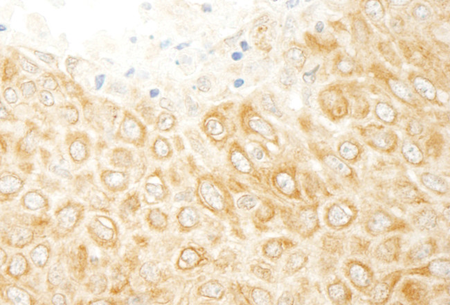 ZAK Antibody in Immunohistochemistry (Paraffin) (IHC (P))