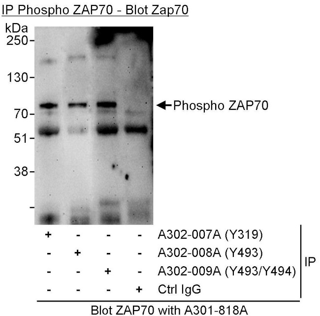 Phospho-ZAP70 (Tyr493, Tyr494) Antibody in Immunoprecipitation (IP)