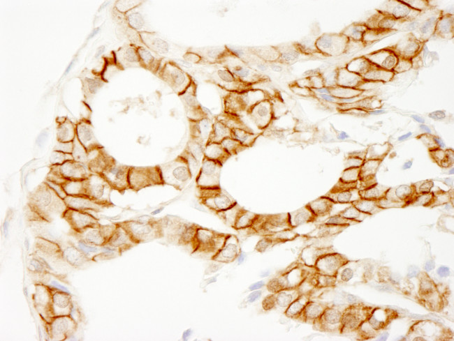 Beta-catenin Antibody in Immunohistochemistry (Paraffin) (IHC (P))