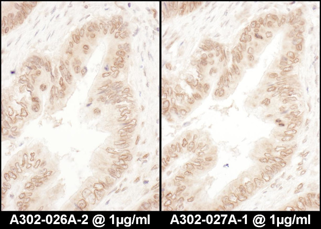 RanGAP1 Antibody in Immunohistochemistry (Paraffin) (IHC (P))