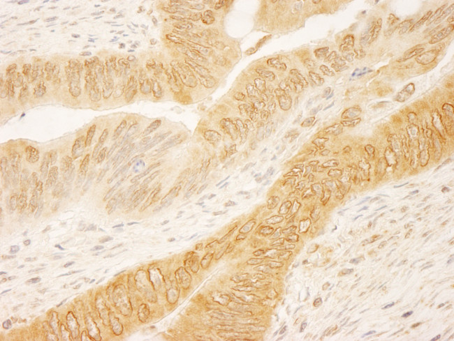 RanGAP1 Antibody in Immunohistochemistry (Paraffin) (IHC (P))