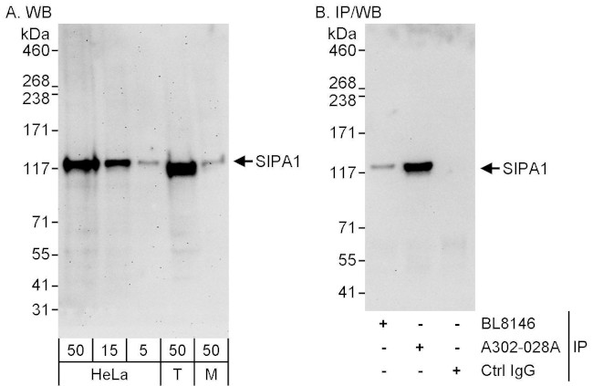 SIPA1 Antibody in Western Blot (WB)