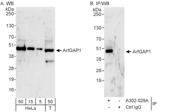 ArfGAP1 Antibody in Western Blot (WB)