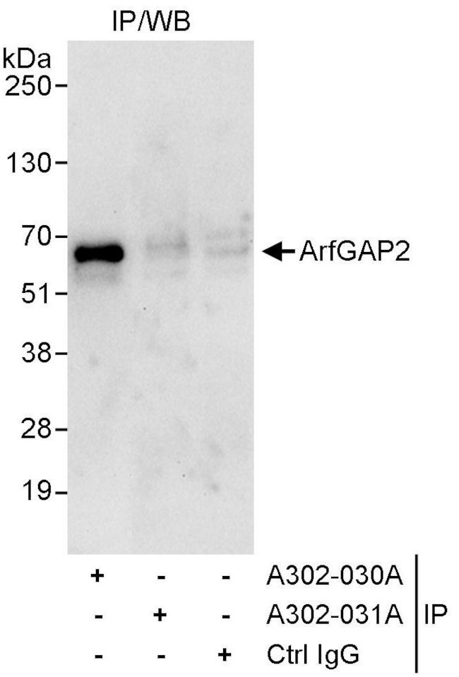 ArfGAP2 Antibody in Immunoprecipitation (IP)
