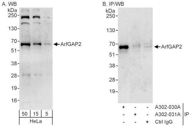 ArfGAP2 Antibody in Western Blot (WB)