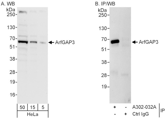 ArfGAP3 Antibody in Western Blot (WB)
