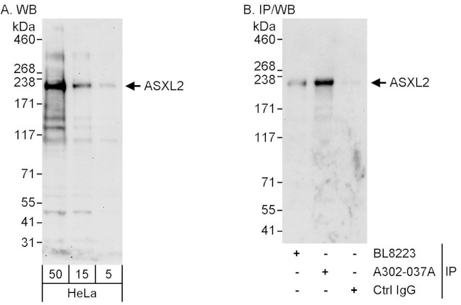 ASXL2 Antibody in Western Blot (WB)