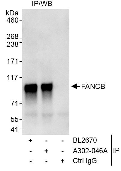 FANCB Antibody in Immunoprecipitation (IP)