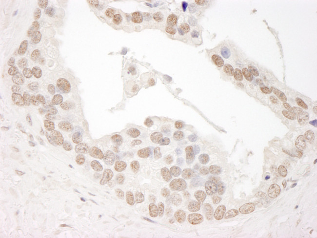 Cyclin L1 Antibody in Immunohistochemistry (Paraffin) (IHC (P))