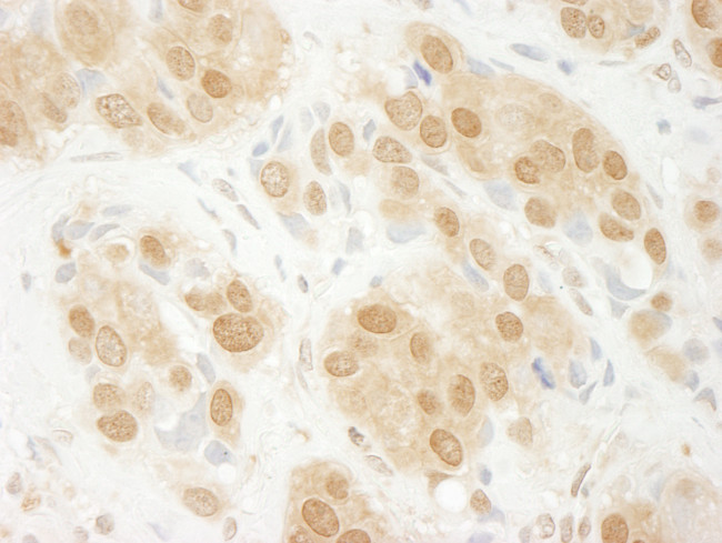 ERK1 Antibody in Immunohistochemistry (Paraffin) (IHC (P))
