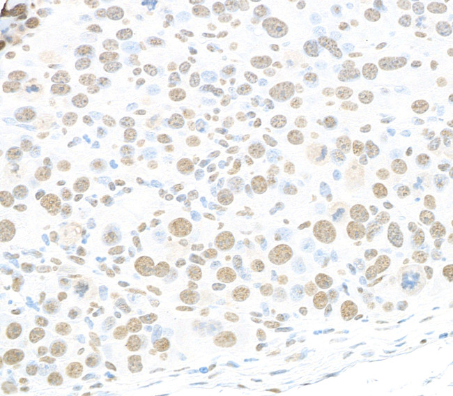 RALY Antibody in Immunohistochemistry (Paraffin) (IHC (P))