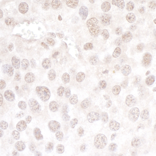 hPrp3p Antibody in Immunohistochemistry (Paraffin) (IHC (P))
