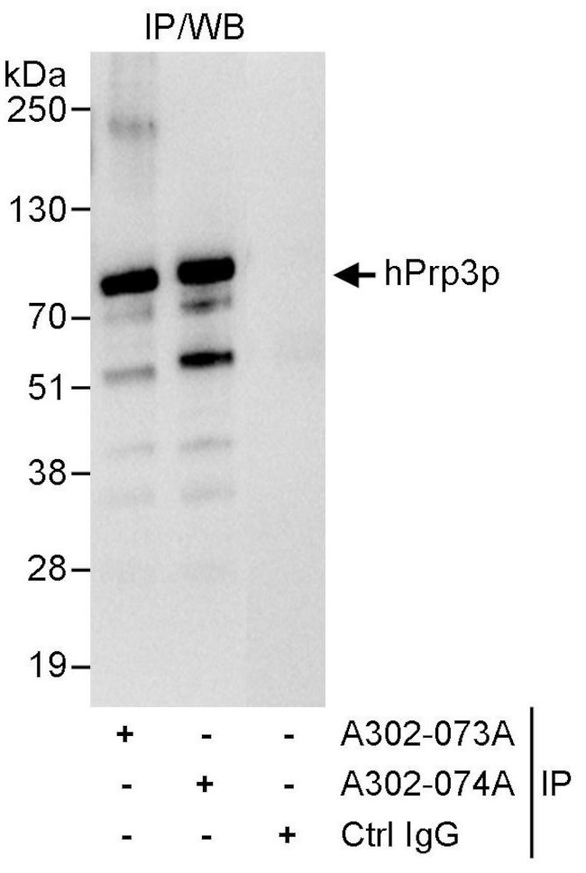 hPrp3p Antibody in Immunoprecipitation (IP)