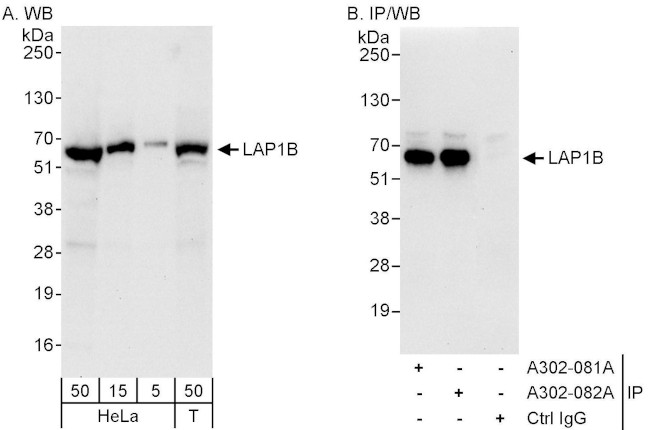 LAP1B Antibody in Western Blot (WB)
