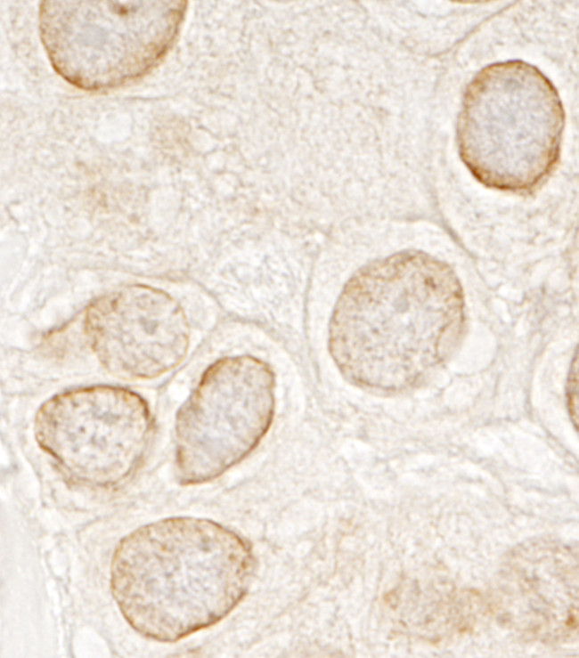 LAP1B Antibody in Immunohistochemistry (Paraffin) (IHC (P))