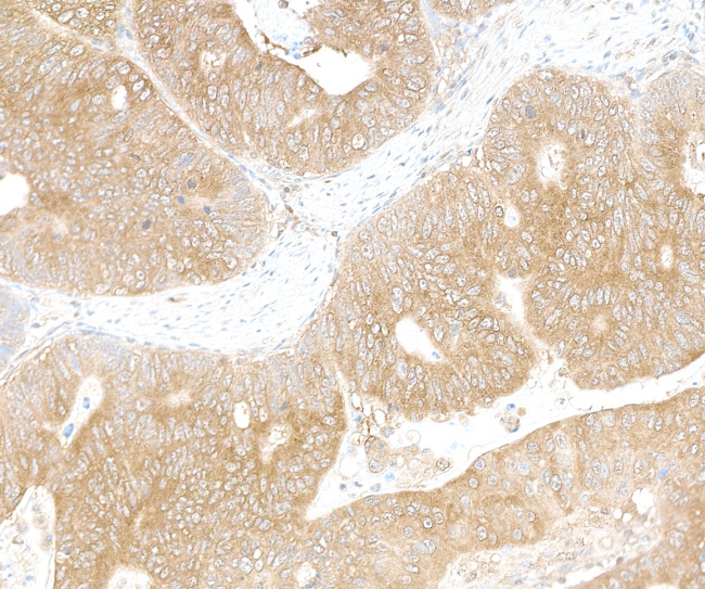 LARP1 Antibody in Immunohistochemistry (Paraffin) (IHC (P))