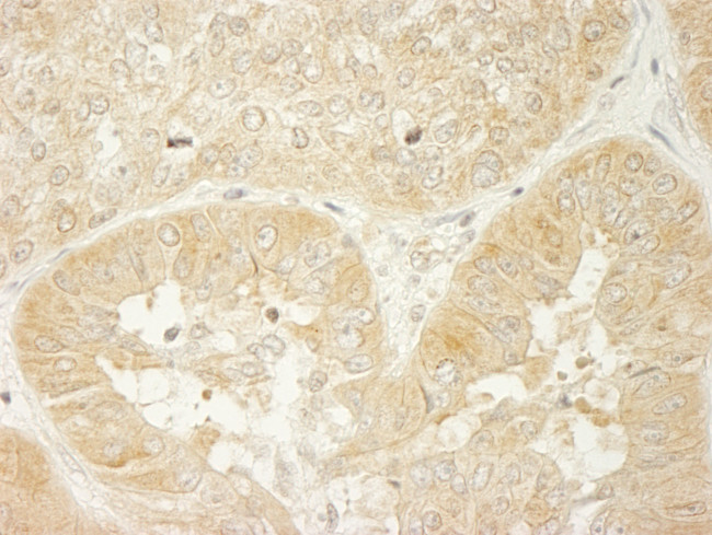 LARP1 Antibody in Immunohistochemistry (Paraffin) (IHC (P))