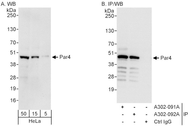 Par4 Antibody in Western Blot (WB)