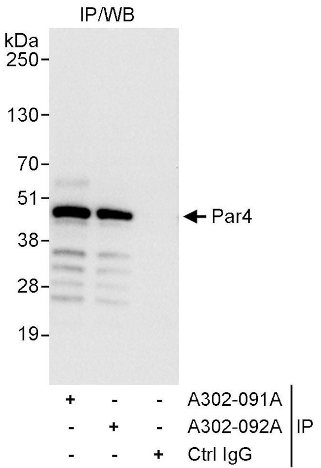 Par4 Antibody in Western Blot (WB)