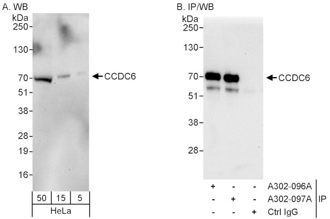CCDC6 Antibody in Western Blot (WB)