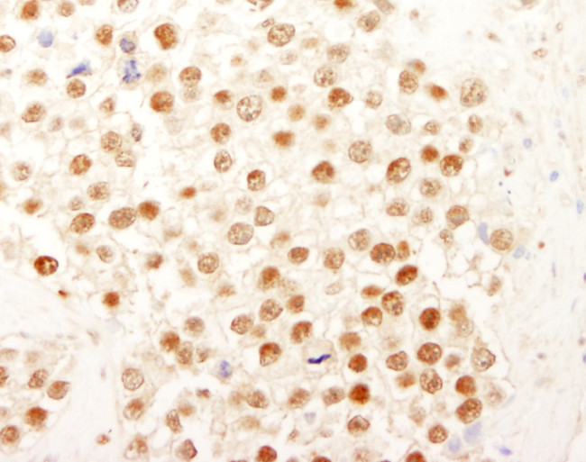 NF-YC Antibody in Immunohistochemistry (Paraffin) (IHC (P))