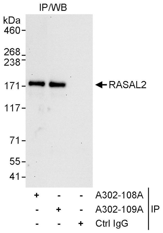 RASAL2 Antibody in Immunoprecipitation (IP)