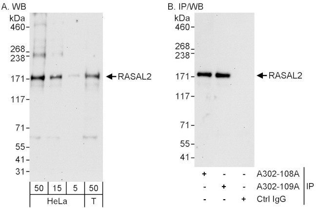 RASAL2 Antibody in Western Blot (WB)