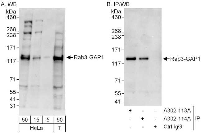 Rab3-GAP1 Antibody in Western Blot (WB)