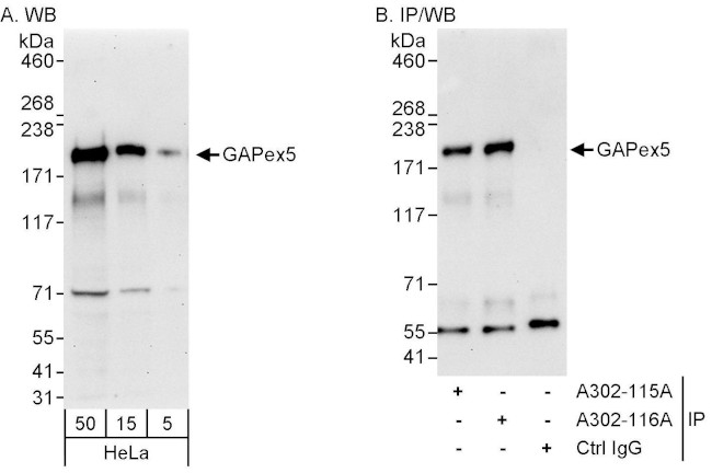 GAPex5 Antibody in Western Blot (WB)