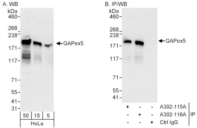 GAPex5 Antibody in Western Blot (WB)