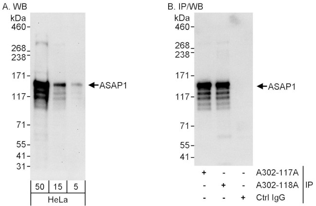 ASAP1 Antibody in Western Blot (WB)