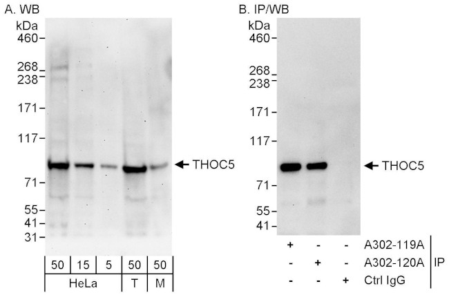THOC5 Antibody in Western Blot (WB)