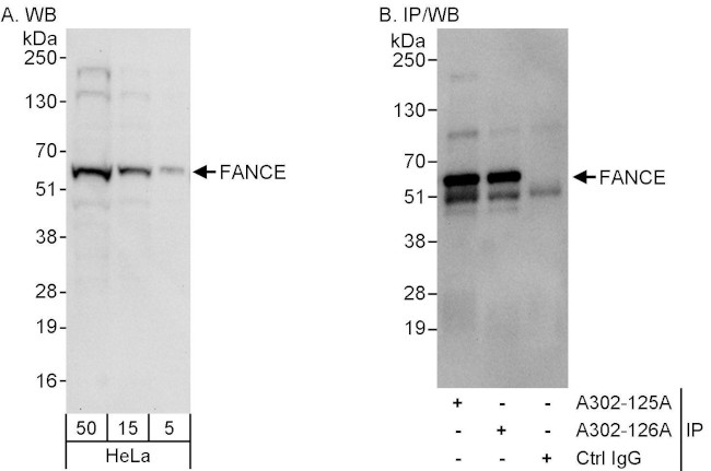 FANCE Antibody in Western Blot (WB)
