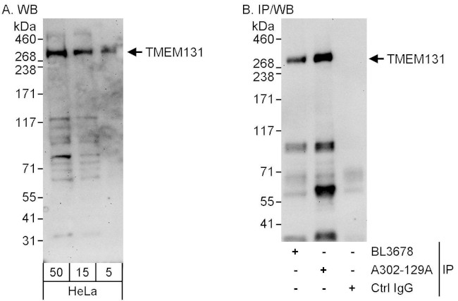 TMEM131 Antibody in Western Blot (WB)