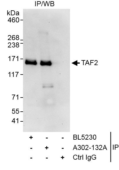 TAF2 Antibody in Immunoprecipitation (IP)