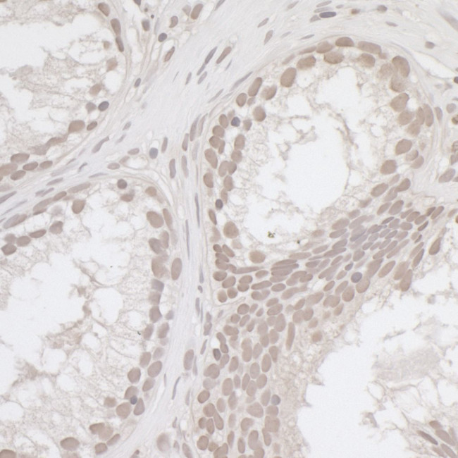 E2F4 Antibody in Immunohistochemistry (Paraffin) (IHC (P))