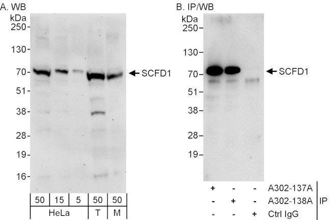 SCFD1 Antibody in Western Blot (WB)