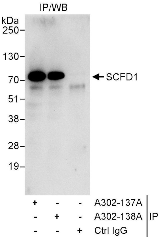 SCFD1 Antibody in Immunoprecipitation (IP)