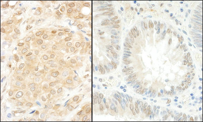 MEK1 Antibody in Immunohistochemistry (Paraffin) (IHC (P))