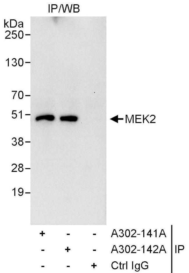 MEK2 Antibody in Immunoprecipitation (IP)
