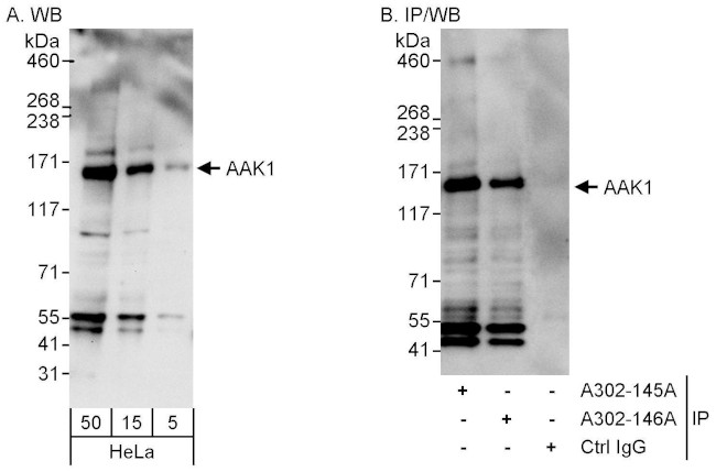 AAK1 Antibody in Western Blot (WB)