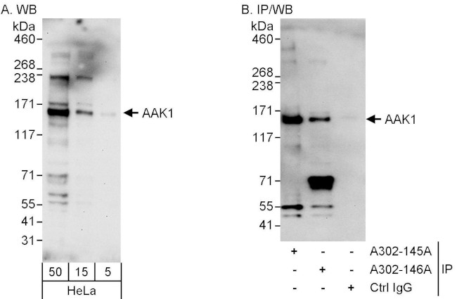 AAK1 Antibody in Western Blot (WB)