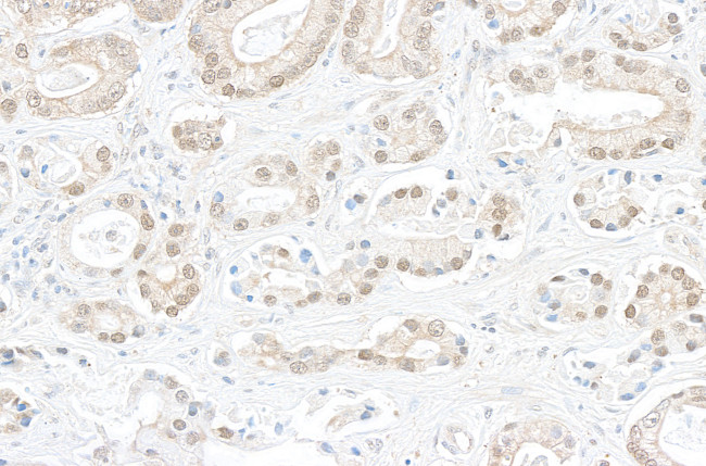 BOP1 Antibody in Immunohistochemistry (Paraffin) (IHC (P))