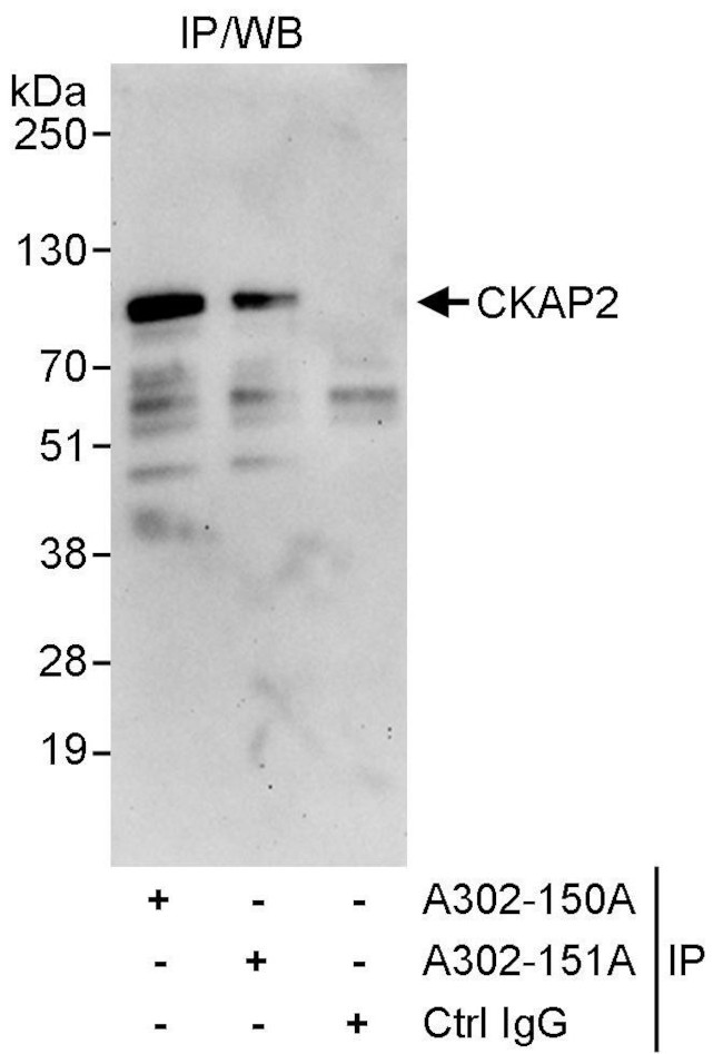 CKAP2 Antibody in Immunoprecipitation (IP)