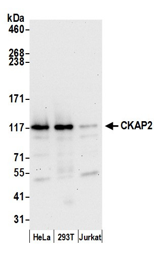 CKAP2 Antibody in Western Blot (WB)