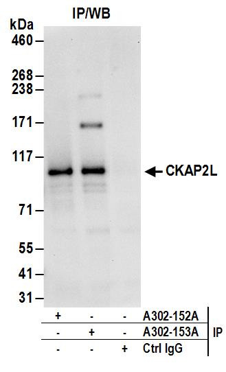 CKAP2L Antibody in Immunoprecipitation (IP)