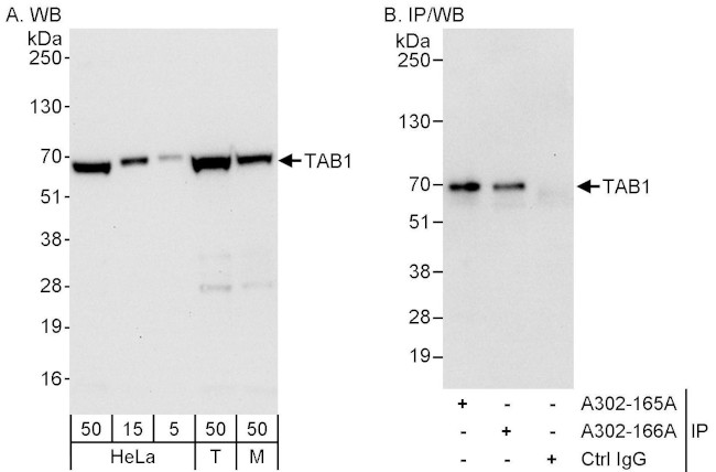 TAB1 Antibody in Western Blot (WB)